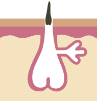脱毛の仕組み3